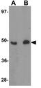 Forkhead Box O4 antibody, GTX31807, GeneTex, Western Blot image 