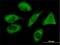 PIH1 Domain Containing 1 antibody, H00055011-M04, Novus Biologicals, Immunofluorescence image 