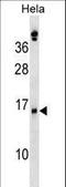 Secretory Leukocyte Peptidase Inhibitor antibody, LS-C161294, Lifespan Biosciences, Western Blot image 