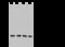 CD97 antigen antibody, 102087-T36, Sino Biological, Western Blot image 