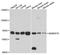 Small Nuclear Ribonucleoprotein U1 Subunit 70 antibody, STJ27859, St John