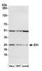 Isopentenyl-diphosphate Delta-isomerase 1 antibody, A305-536A, Bethyl Labs, Western Blot image 