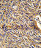 3,2-trans-enoyl-CoA isomerase, mitochondrial antibody, A09974-1, Boster Biological Technology, Immunohistochemistry paraffin image 