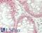 CLDN7 antibody, LS-B14354, Lifespan Biosciences, Immunohistochemistry paraffin image 