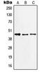 Jun Proto-Oncogene, AP-1 Transcription Factor Subunit antibody, LS-C352433, Lifespan Biosciences, Western Blot image 