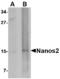 Nanos C2HC-Type Zinc Finger 2 antibody, LS-C53318, Lifespan Biosciences, Western Blot image 