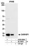 Calcium Regulated Heat Stable Protein 1 antibody, A303-908A, Bethyl Labs, Immunoprecipitation image 