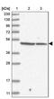 F-Box And Leucine Rich Repeat Protein 8 antibody, PA5-57326, Invitrogen Antibodies, Western Blot image 