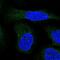 ALG9 Alpha-1,2-Mannosyltransferase antibody, PA5-58447, Invitrogen Antibodies, Immunofluorescence image 