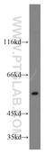 Rh Family C Glycoprotein antibody, 11949-1-AP, Proteintech Group, Western Blot image 