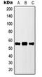 Cytochrome P450 Family 2 Subfamily D Member 6 antibody, orb213822, Biorbyt, Western Blot image 