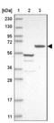 Coiled-Coil Domain Containing 17 antibody, NBP1-93860, Novus Biologicals, Western Blot image 
