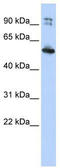 Dynein Axonemal Assembly Factor 1 antibody, TA337574, Origene, Western Blot image 