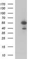 Fibrinogen Gamma Chain antibody, LS-C338374, Lifespan Biosciences, Western Blot image 