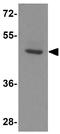 LanC Like 2 antibody, GTX17258, GeneTex, Western Blot image 