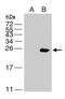 Japanese Encephalitis Virus NS4B  antibody, NBP2-42895, Novus Biologicals, Western Blot image 