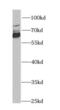 Delta-1-pyrroline-5-carboxylate dehydrogenase, mitochondrial antibody, FNab00296, FineTest, Western Blot image 