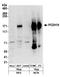Protocadherin 19 antibody, A304-468A, Bethyl Labs, Western Blot image 