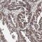 ADP Ribosylation Factor Like GTPase 2 antibody, FNab00574, FineTest, Immunohistochemistry paraffin image 
