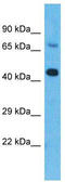 Zinc Finger DHHC-Type Containing 20 antibody, TA330835, Origene, Western Blot image 