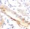 Selectin E antibody, FNab02863, FineTest, Immunohistochemistry paraffin image 