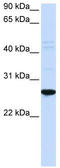 Dorsal Root Ganglia Homeobox antibody, TA342417, Origene, Western Blot image 