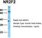 Nuclear Receptor Subfamily 2 Group F Member 2 antibody, TA345312, Origene, Western Blot image 