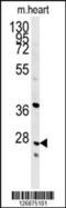 Indolethylamine N-Methyltransferase antibody, 61-943, ProSci, Western Blot image 