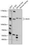 Inv antibody, 13-565, ProSci, Western Blot image 