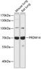 PR/SET Domain 14 antibody, A03870-1, Boster Biological Technology, Western Blot image 