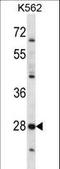 Serine Protease 27 antibody, LS-C162194, Lifespan Biosciences, Western Blot image 