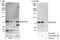 Probable ATP-dependent RNA helicase DDX59 antibody, A303-028A, Bethyl Labs, Western Blot image 