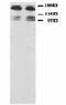 NMDAR2B antibody, LS-C171802, Lifespan Biosciences, Western Blot image 