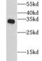 Clathrin Light Chain B antibody, FNab01778, FineTest, Western Blot image 
