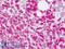 Zinc finger protein ZIC 4 antibody, LS-B9034, Lifespan Biosciences, Immunohistochemistry paraffin image 