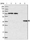Chromosome 11 Open Reading Frame 54 antibody, PA5-59202, Invitrogen Antibodies, Western Blot image 