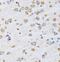 Peptidyl-TRNA Hydrolase 2 antibody, FNab06951, FineTest, Immunohistochemistry paraffin image 