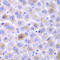 Epoxide Hydrolase 1 antibody, STJ23551, St John