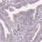 Chromosome 1 Open Reading Frame 194 antibody, NBP2-38605, Novus Biologicals, Immunohistochemistry frozen image 
