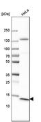 Cancer/Testis Antigen 83 antibody, HPA004773, Atlas Antibodies, Western Blot image 