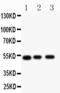 Muscarinic acetylcholine receptor M2 antibody, PA1325-1, Boster Biological Technology, Western Blot image 