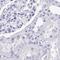 Spermatid Associated antibody, PA5-58752, Invitrogen Antibodies, Immunohistochemistry frozen image 