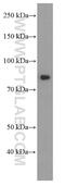 Phosphatidylinositol 3-kinase regulatory subunit alpha antibody, 60225-1-Ig, Proteintech Group, Western Blot image 