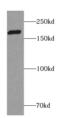 Regulating Synaptic Membrane Exocytosis 1 antibody, FNab07300, FineTest, Western Blot image 