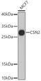 CSN2 antibody, GTX66115, GeneTex, Western Blot image 