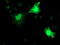 Regulatory Factor X Associated Ankyrin Containing Protein antibody, M07934, Boster Biological Technology, Immunofluorescence image 