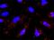 Glutamate Ionotropic Receptor NMDA Type Subunit 2B antibody, H00002904-M01, Novus Biologicals, Proximity Ligation Assay image 