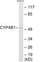 Cytochrome P450 Family 4 Subfamily B Member 1 antibody, EKC1921, Boster Biological Technology, Western Blot image 