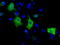 Sterol O-Acyltransferase 2 antibody, LS-C115249, Lifespan Biosciences, Immunofluorescence image 