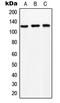 Solute Carrier Family 24 Member 1 antibody, LS-C353140, Lifespan Biosciences, Western Blot image 